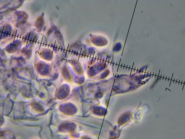 Botryobasidium con spore finemente verrucose